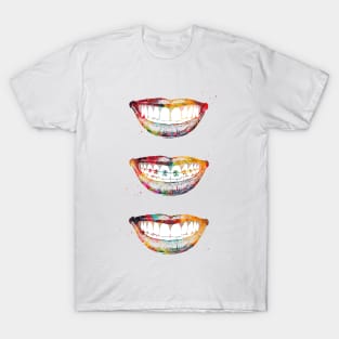 Before, with and after braces T-Shirt